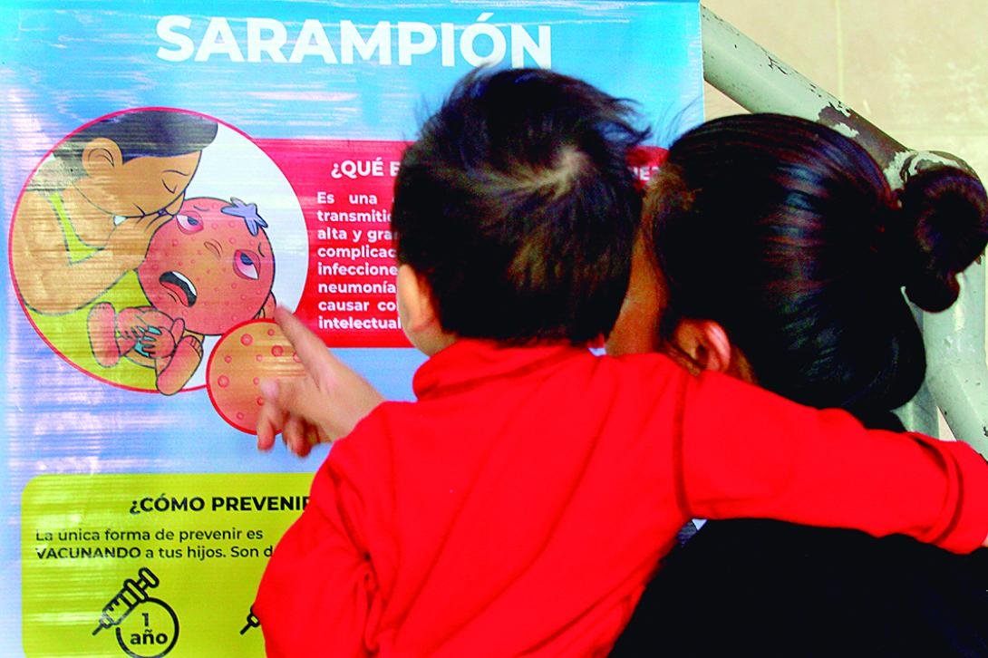 Ministerio de Salud emite recomendaciones ante casos de sarampión