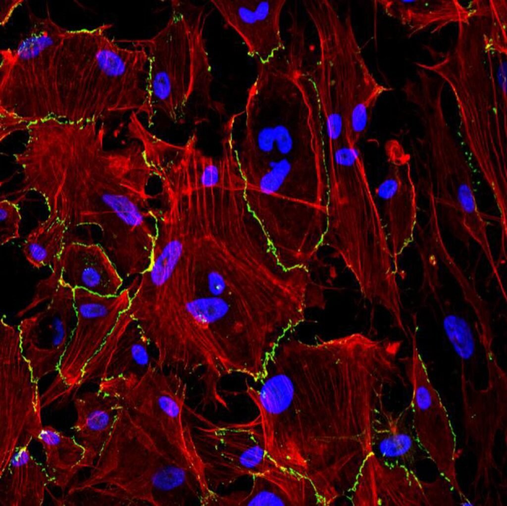 Científicos desarrollan hidrogel en spray para prevenir adhesiones tras cirugías abdominales