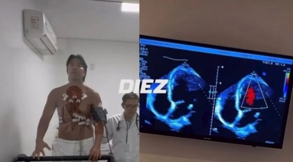 Marcelo Martins avanza firme en su retorno al fútbol