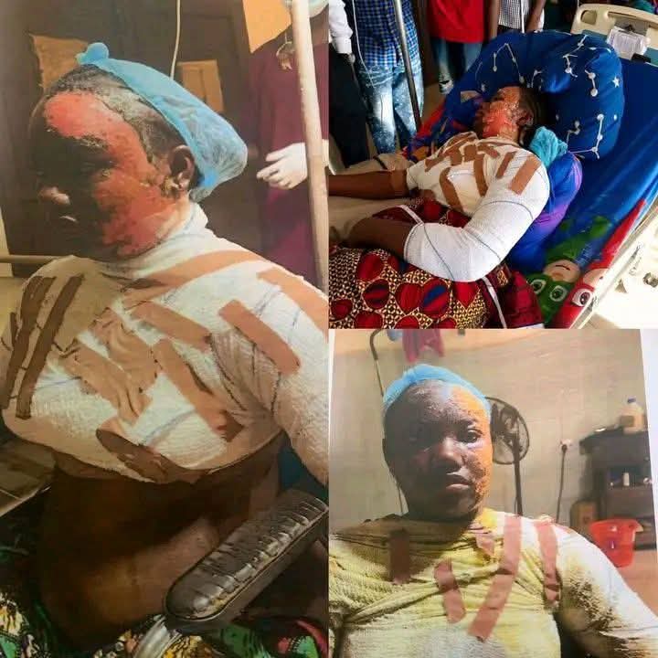 Estudiante de Benue Varsity arrestado por verter agua caliente a un compañero de cuarto