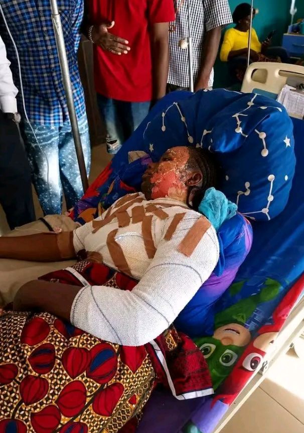 Estudiante de Benue Varsity arrestado por verter agua caliente a un compañero de cuarto