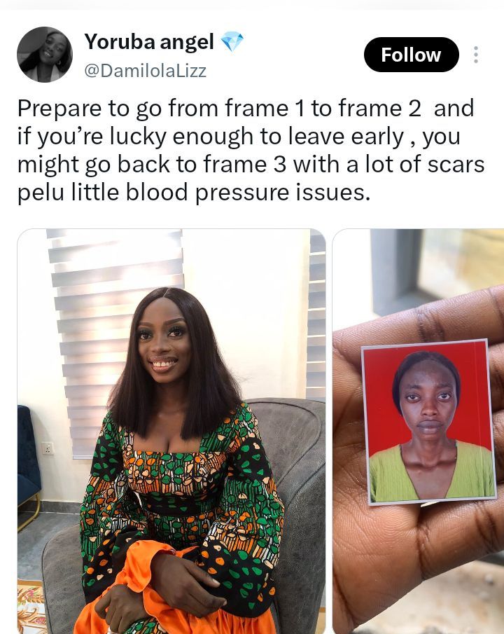 Una-mujer-nigeriana-comparte-fotos-suyas-de-antes-y-despues.jpg