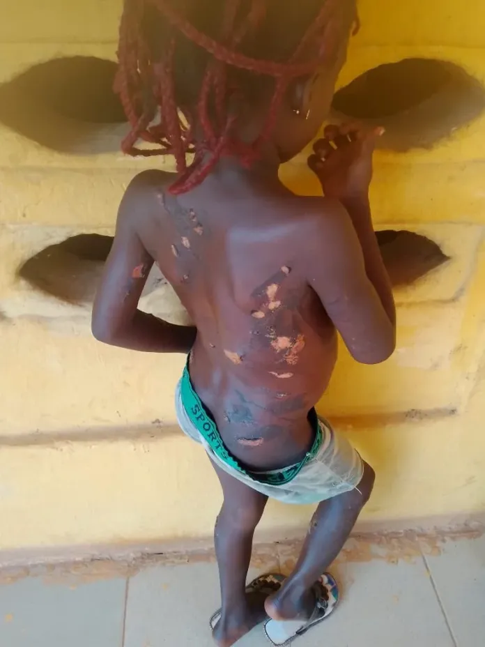 Madre arrestada en Anambra por usar un cuchillo caliente con su hija de 7 años
