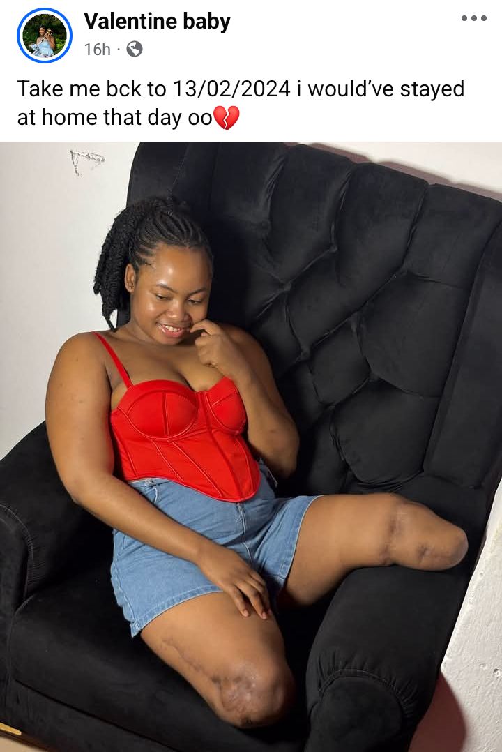 Ojalá me hubiera quedado en casa ese día: una mujer nigeriana que perdió ambas piernas en un accidente comparte su pesar