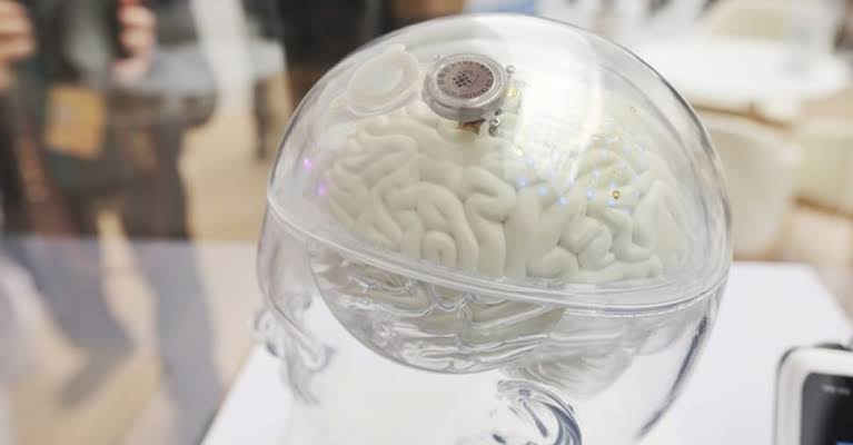 China-aprueba-implante-cerebral-para-ayudar-a-pacientes-paralizados-a.jpeg